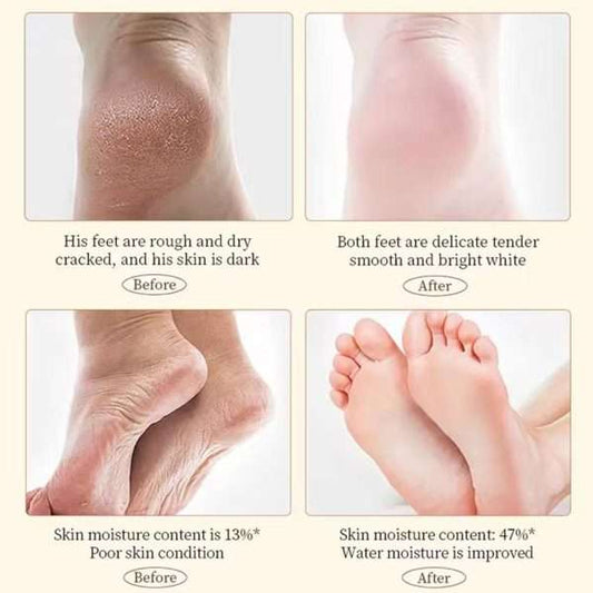 Hand & Foot Cream | Deep Hydration for Soft and Smooth Skin